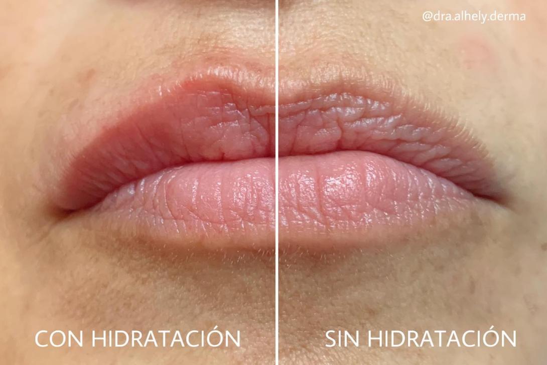 RealHhidra