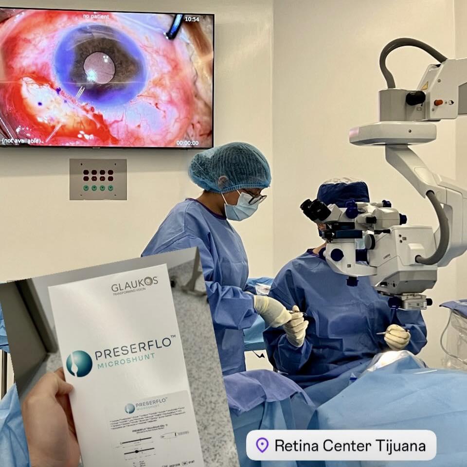 Retina sur