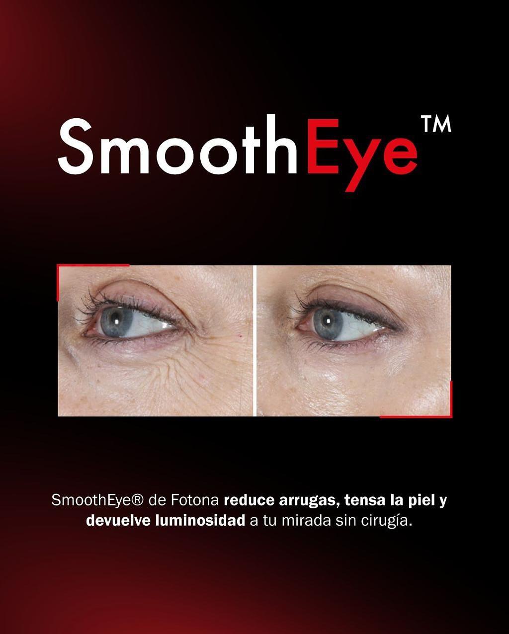 Beyou eyes