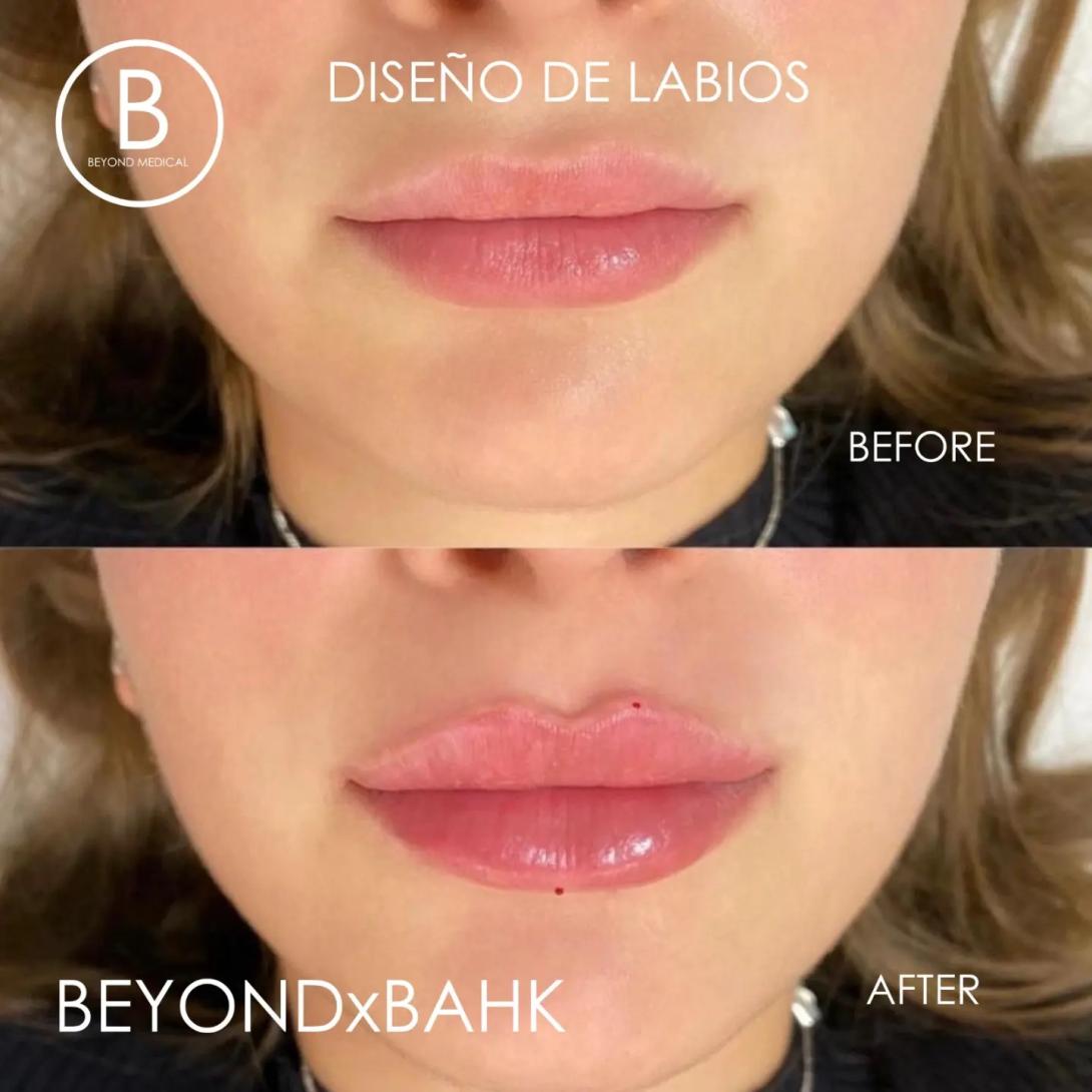 Beyond lips