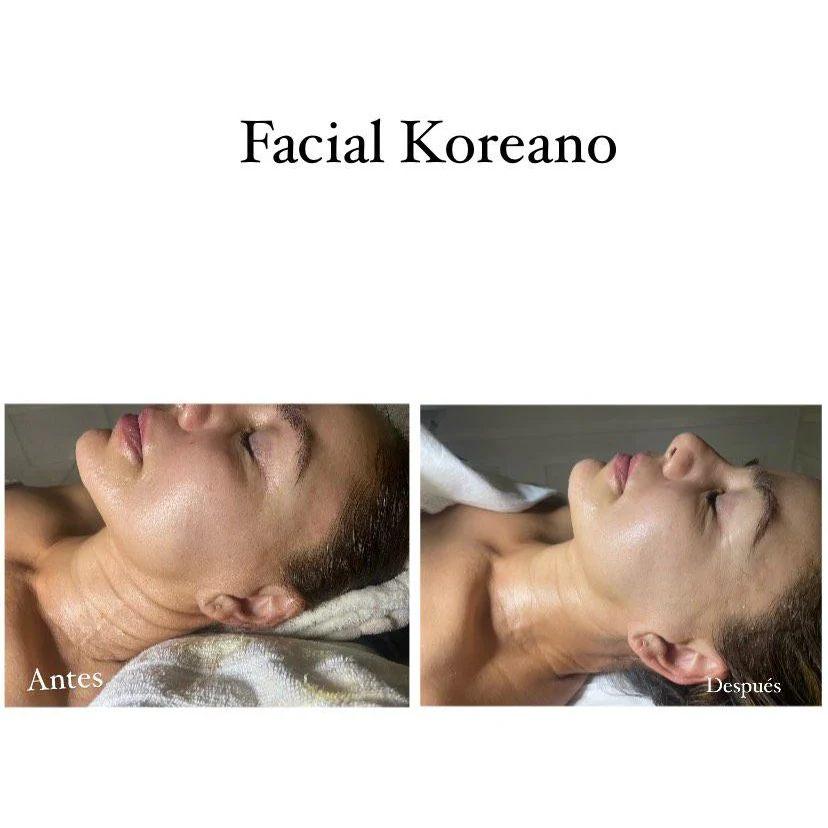 Loft facial
