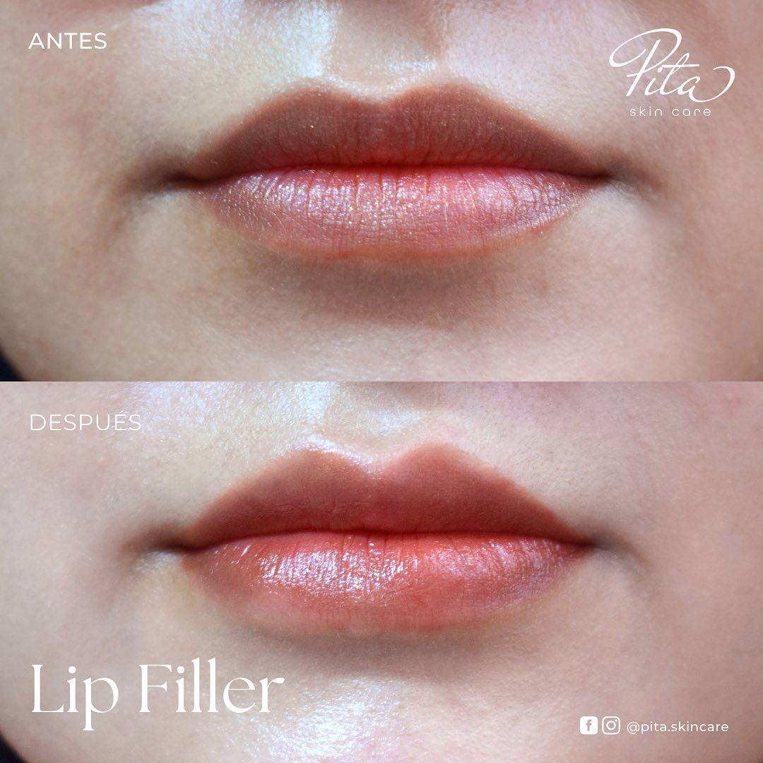 Pita lips