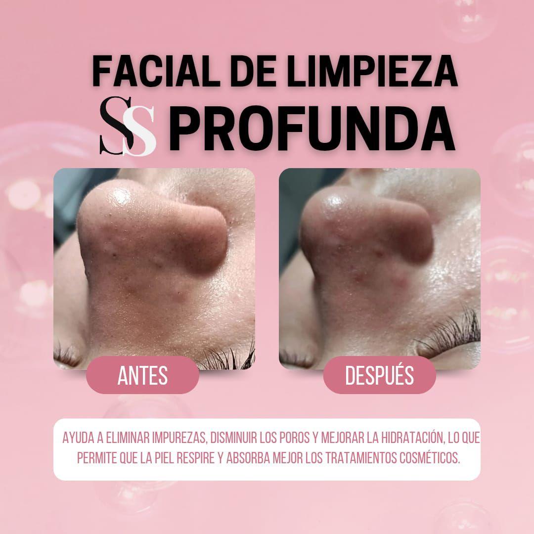 sharon nose