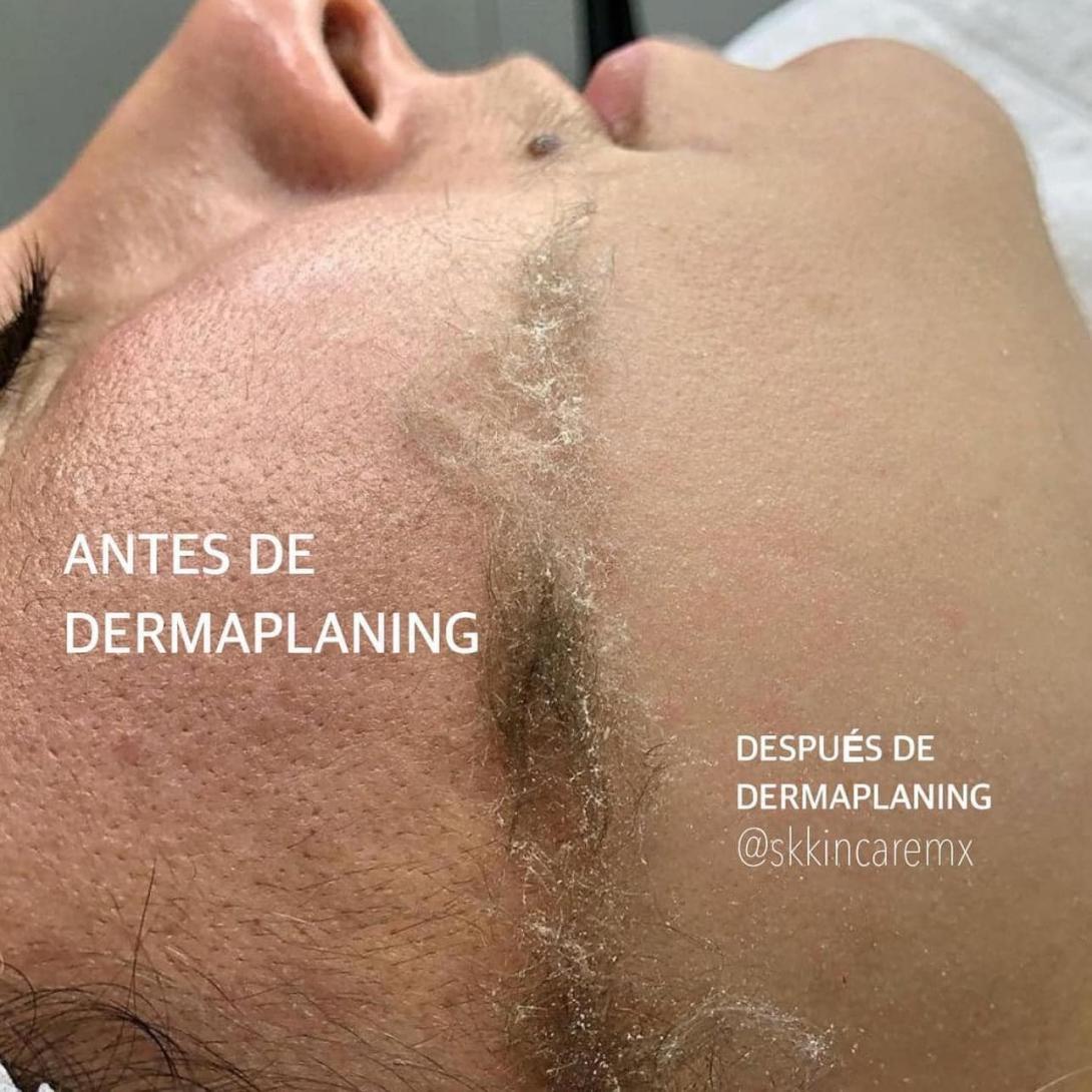 SKderma