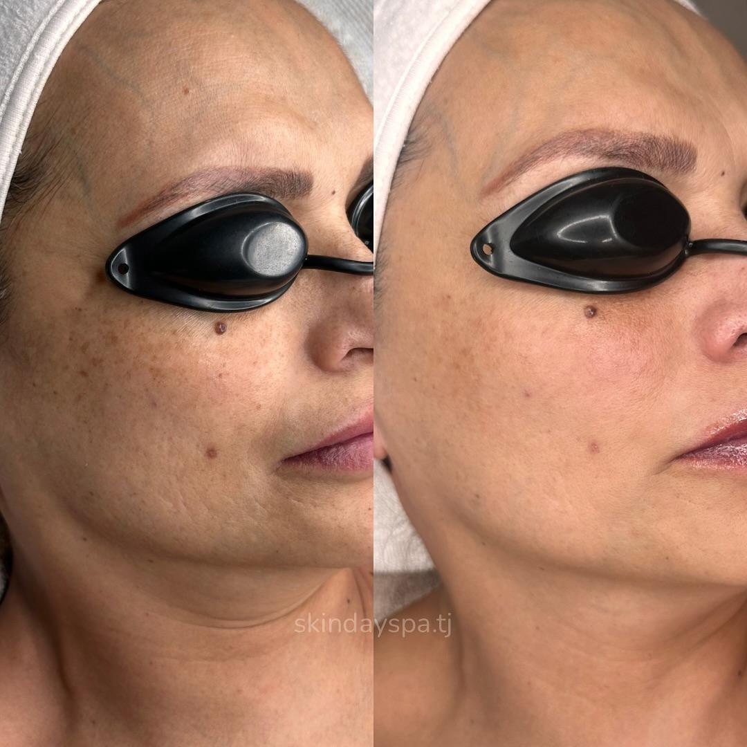 Skinday skin