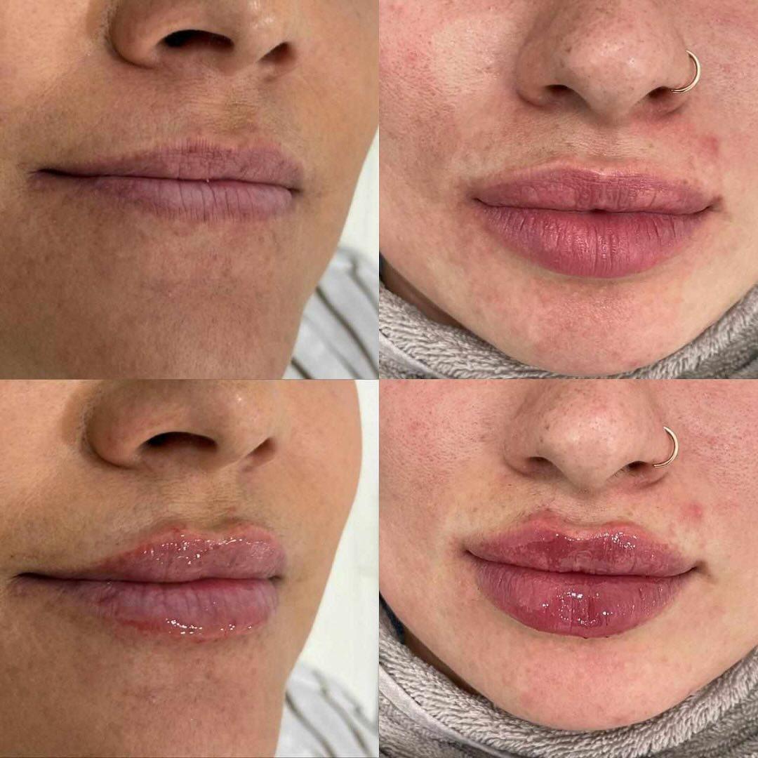 Sunshine labios