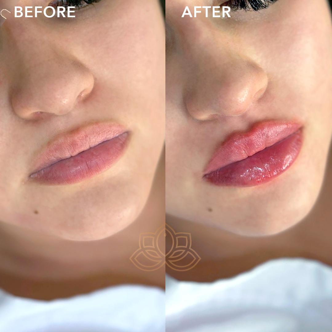 Vive labios