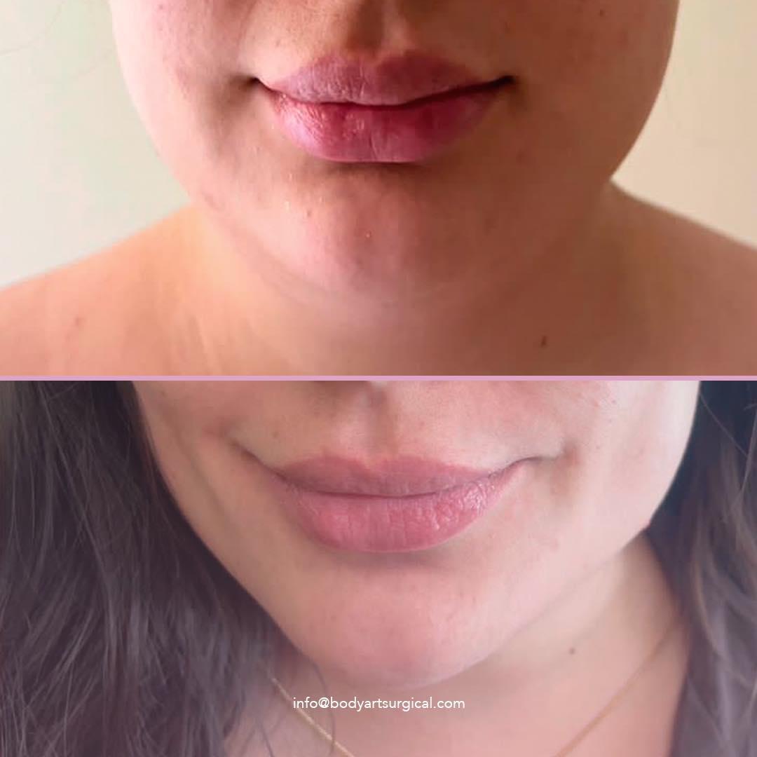 Bodyartlips