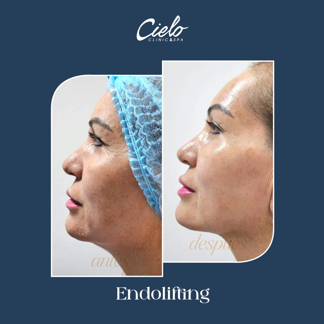 CIELO AD