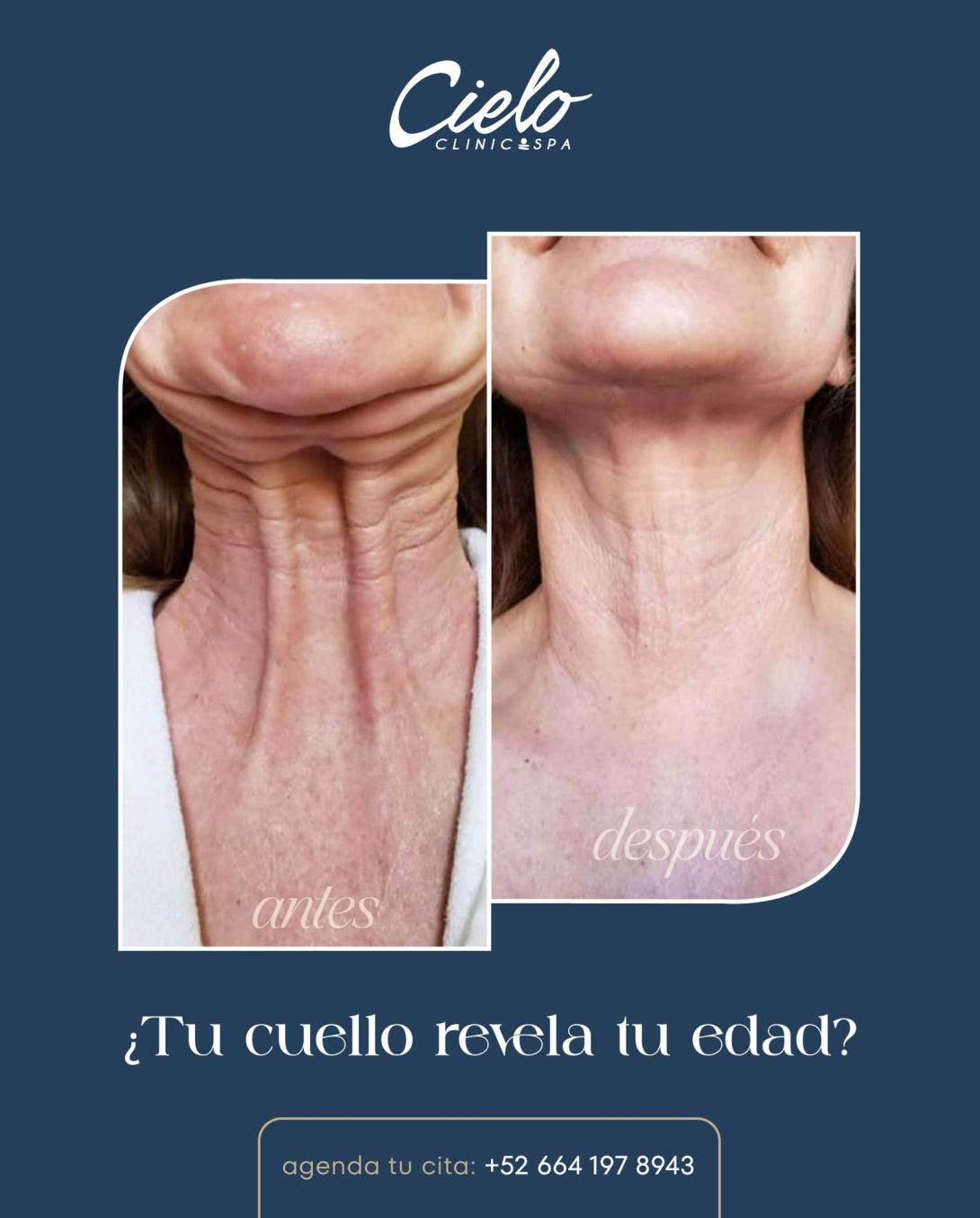 CIELO cuello