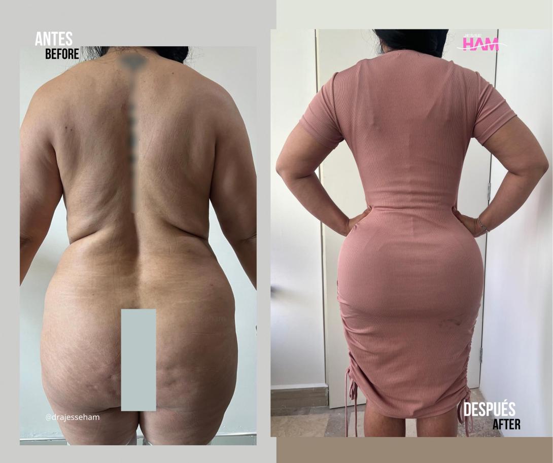 Ham AD