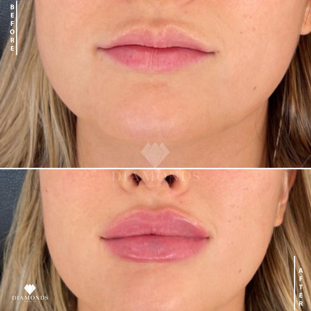 lotus lips