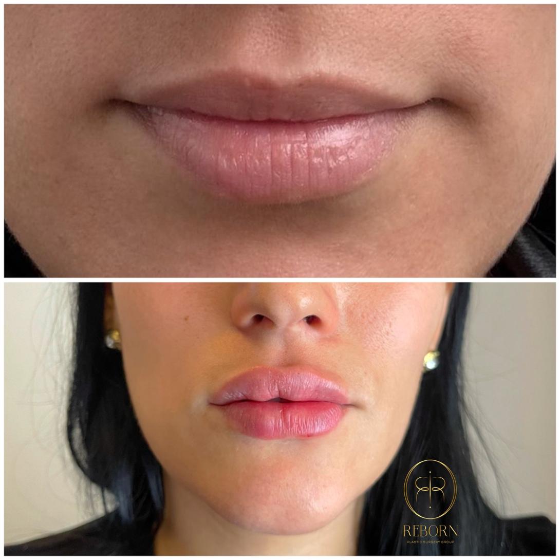 Najar lips